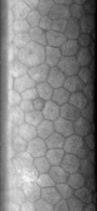 Endothélium cornéen - vue lamellaire au microscope